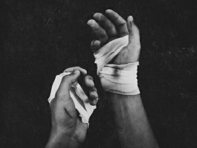 Dikiş Yeri ve Yara&nbsp;İzi